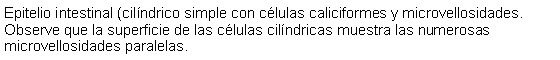 Cuadro de texto: Epitelio intestinal (cilndrico simple con clulas caliciformes y microvellosidades. Observe que la superficie de las clulas cilndricas muestra las numerosas microvellosidades paralelas.  