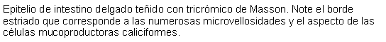 Cuadro de texto: Epitelio de intestino delgado teido con tricrmico de Masson. Note el borde estriado que corresponde a las numerosas microvellosidades y el aspecto de las clulas mucoproductoras caliciformes. 