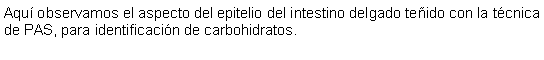 Cuadro de texto: Aqu observamos el aspecto del epitelio del intestino delgado teido con la tcnica de PAS, para identificacin de carbohidratos. 