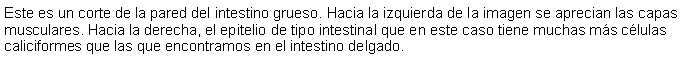 Cuadro de texto: Este es un corte de la pared del intestino grueso. Hacia la izquierda de la imagen se aprecian las capas musculares. Hacia la derecha, el epitelio de tipo intestinal que en este caso tiene muchas ms clulas caliciformes que las que encontramos en el intestino delgado.   