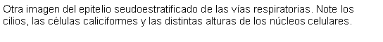 Cuadro de texto: Otra imagen del epitelio seudoestratificado de las vas respiratorias. Note los cilios, las clulas caliciformes y las distintas alturas de los ncleos celulares. 