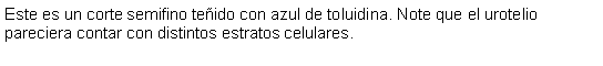 Cuadro de texto: Este es un corte semifino teido con azul de toluidina. Note que el urotelio pareciera contar con distintos estratos celulares. 