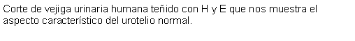 Cuadro de texto: Corte de vejiga urinaria humana teido con H y E que nos muestra el aspecto caracterstico del urotelio normal.