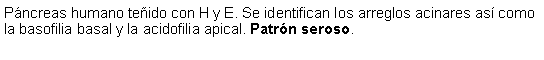 Cuadro de texto: Pncreas humano teido con H y E. Se identifican los arreglos acinares as como la basofilia basal y la acidofilia apical. Patrn seroso.