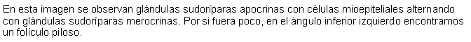 Cuadro de texto: En esta imagen se observan glndulas sudorparas apocrinas con clulas mioepiteliales alternando con glndulas sudorparas merocrinas. Por si fuera poco, en el ngulo inferior izquierdo encontramos un folculo piloso.