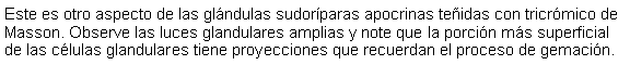 Cuadro de texto: Este es otro aspecto de las glndulas sudorparas apocrinas teidas con tricrmico de Masson. Observe las luces glandulares amplias y note que la porcin ms superficial de las clulas glandulares tiene proyecciones que recuerdan el proceso de gemacin. 