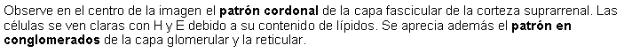 Cuadro de texto: Observe en el centro de la imagen el patrn cordonal de la capa fascicular de la corteza suprarrenal. Las clulas se ven claras con H y E debido a su contenido de lpidos. Se aprecia adems el patrn en conglomerados de la capa glomerular y la reticular.