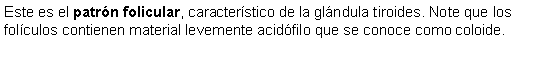 Cuadro de texto: Este es el patrn folicular, caracterstico de la glndula tiroides. Note que los folculos contienen material levemente acidfilo que se conoce como coloide. 