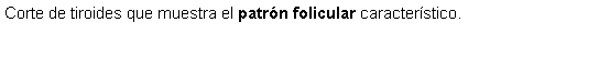Cuadro de texto: Corte de tiroides que muestra el patrn folicular caracterstico.