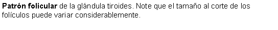 Cuadro de texto: Patrn folicular de la glndula tiroides. Note que el tamao al corte de los folculos puede variar considerablemente.