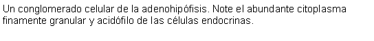 Cuadro de texto: Un conglomerado celular de la adenohipfisis. Note el abundante citoplasma finamente granular y acidfilo de las clulas endocrinas.