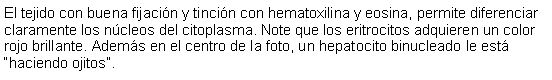 Cuadro de texto: El tejido con buena fijacin y tincin con hematoxilina y eosina, permite diferenciar claramente los ncleos del citoplasma. Note que los eritrocitos adquieren un color rojo brillante. Adems en el centro de la foto, un hepatocito binucleado le est haciendo ojitos.