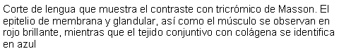 Cuadro de texto: Corte de lengua que muestra el contraste con tricrmico de Masson. El epitelio de membrana y glandular, as como el msculo se observan en rojo brillante, mientras que el tejido conjuntivo con colgena se identifica en azul 