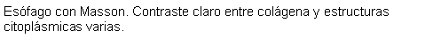 Cuadro de texto: Esfago con Masson. Contraste claro entre colgena y estructuras citoplsmicas varias.