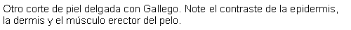 Cuadro de texto: Otro corte de piel delgada con Gallego. Note el contraste de la epidermis, la dermis y el msculo erector del pelo.