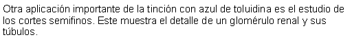 Cuadro de texto: Otra aplicacin importante de la tincin con azul de toluidina es el estudio de los cortes semifinos. Este muestra el detalle de un glomrulo renal y sus tbulos. 