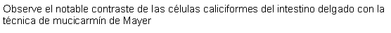 Cuadro de texto: Observe el notable contraste de las clulas caliciformes del intestino delgado con la tcnica de mucicarmn de Mayer 