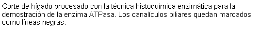 Cuadro de texto: Corte de hgado procesado con la tcnica histoqumica enzimtica para la demostracin de la enzima ATPasa. Los canalculos biliares quedan marcados como lneas negras.