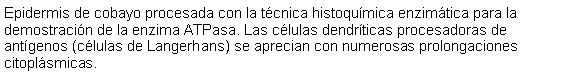 Cuadro de texto: Epidermis de cobayo procesada con la tcnica histoqumica enzimtica para la demostracin de la enzima ATPasa. Las clulas dendrticas procesadoras de antgenos (clulas de Langerhans) se aprecian con numerosas prolongaciones citoplsmicas. 