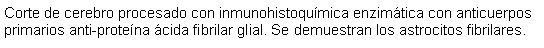 Cuadro de texto: Corte de cerebro procesado con inmunohistoquímica enzimática con anticuerpos primarios anti-proteína ácida fibrilar glial. Se demuestran los astrocitos fibrilares.
