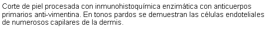 Cuadro de texto: Corte de piel procesada con inmunohistoqumica enzimtica con anticuerpos primarios anti-vimentina. En tonos pardos se demuestran las clulas endoteliales de numerosos capilares de la dermis.