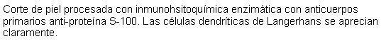 Cuadro de texto: Corte de piel procesada con inmunohsitoqumica enzimtica con anticuerpos primarios anti-protena S-100. Las clulas dendrticas de Langerhans se aprecian claramente.