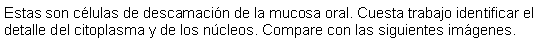 Cuadro de texto: Estas son clulas de descamacin de la mucosa oral. Cuesta trabajo identificar el detalle del citoplasma y de los ncleos. Compare con las siguientes imgenes.