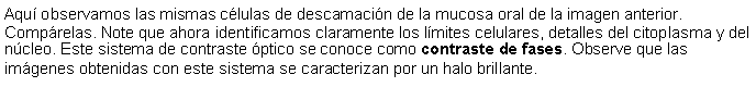 Cuadro de texto: Aqu observamos las mismas clulas de descamacin de la mucosa oral de la imagen anterior. Comprelas. Note que ahora identificamos claramente los lmites celulares, detalles del citoplasma y del ncleo. Este sistema de contraste ptico se conoce como contraste de fases. Observe que las imgenes obtenidas con este sistema se caracterizan por un halo brillante.  