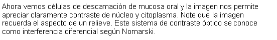 Cuadro de texto: Ahora vemos clulas de descamacin de mucosa oral y la imagen nos permite apreciar claramente contraste de ncleo y citoplasma. Note que la imagen recuerda el aspecto de un relieve. Este sistema de contraste ptico se conoce como interferencia diferencial segn Nomarski. 