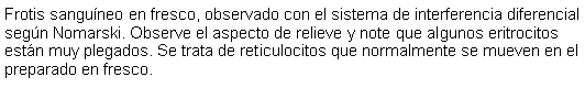 Cuadro de texto: Frotis sanguneo en fresco, observado con el sistema de interferencia diferencial segn Nomarski. Observe el aspecto de relieve y note que algunos eritrocitos estn muy plegados. Se trata de reticulocitos que normalmente se mueven en el preparado en fresco. 