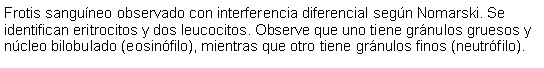 Cuadro de texto: Frotis sanguneo observado con interferencia diferencial segn Nomarski. Se identifican eritrocitos y dos leucocitos. Observe que uno tiene grnulos gruesos y ncleo bilobulado (eosinfilo), mientras que otro tiene grnulos finos (neutrfilo).