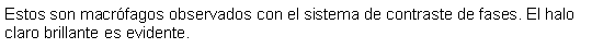 Cuadro de texto: Estos son macrfagos observados con el sistema de contraste de fases. El halo claro brillante es evidente.