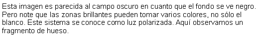 Cuadro de texto: Esta imagen es parecida al campo oscuro en cuanto que el fondo se ve negro. Pero note que las zonas brillantes pueden tomar varios colores, no slo el blanco. Este sistema se conoce como luz polarizada. Aqu observamos un fragmento de hueso.