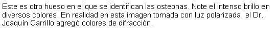 Cuadro de texto: Este es otro hueso en el que se identifican las osteonas. Note el intenso brillo en diversos colores. En realidad en esta imagen tomada con luz polarizada, el Dr. Joaqun Carrillo agreg colores de difraccin.