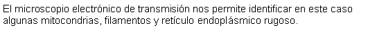 Cuadro de texto: El microscopio electrnico de transmisin nos permite identificar en este caso algunas mitocondrias, filamentos y retculo endoplsmico rugoso. 