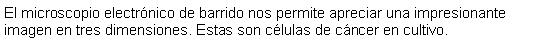 Cuadro de texto: El microscopio electrnico de barrido nos permite apreciar una impresionante imagen en tres dimensiones. Estas son clulas de cncer en cultivo.