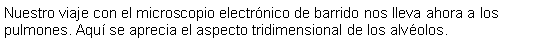 Cuadro de texto: Nuestro viaje con el microscopio electrnico de barrido nos lleva ahora a los pulmones. Aqu se aprecia el aspecto tridimensional de los alvolos.  