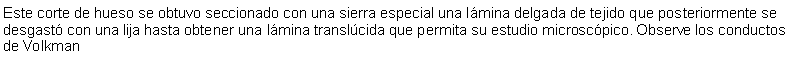 Cuadro de texto: Este corte de hueso se obtuvo seccionado con una sierra especial una lmina delgada de tejido que posteriormente se desgast con una lija hasta obtener una lmina translcida que permita su estudio microscpico. Observe los conductos de Volkman