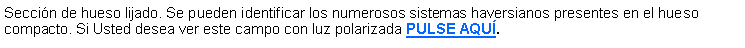 Cuadro de texto: Seccin de hueso lijado. Se pueden identificar los numerosos sistemas haversianos presentes en el hueso compacto. Si Usted desea ver este campo con luz polarizada PULSE AQU.