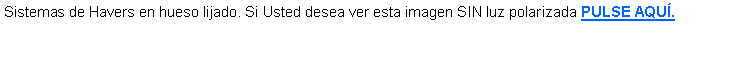 Cuadro de texto: Sistemas de Havers en hueso lijado. Si Usted desea ver esta imagen SIN luz polarizada PULSE AQU.