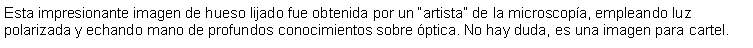 Cuadro de texto: Esta impresionante imagen de hueso lijado fue obtenida por un artista de la microscopa, empleando luz polarizada y echando mano de profundos conocimientos sobre ptica. No hay duda, es una imagen para cartel. 