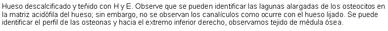 Cuadro de texto: Hueso descalcificado y teido con H y E. Observe que se pueden identificar las lagunas alargadas de los osteocitos en la matriz acidfila del hueso; sin embargo, no se observan los canalculos como ocurre con el hueso lijado. Se puede identificar el perfil de las osteonas y hacia el extremo inferior derecho, observamos tejido de mdula sea.