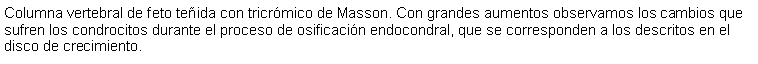 Cuadro de texto: Columna vertebral de feto teida con tricrmico de Masson. Con grandes aumentos observamos los cambios que sufren los condrocitos durante el proceso de osificacin endocondral, que se corresponden a los descritos en el disco de crecimiento.  