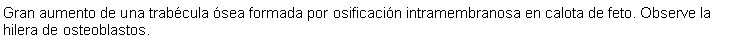 Cuadro de texto: Gran aumento de una trabcula sea formada por osificacin intramembranosa en calota de feto. Observe la hilera de osteoblastos.