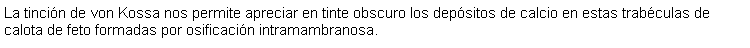 Cuadro de texto: La tincin de von Kossa nos permite apreciar en tinte obscuro los depsitos de calcio en estas trabculas de calota de feto formadas por osificacin intramambranosa.