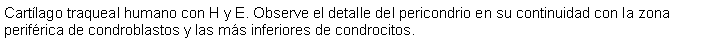 Cuadro de texto: Cartlago traqueal humano con H y E. Observe el detalle del pericondrio en su continuidad con la zona perifrica de condroblastos y las ms inferiores de condrocitos. 