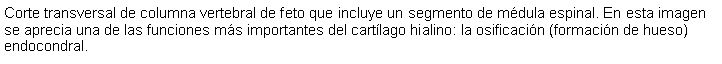 Cuadro de texto: Corte transversal de columna vertebral de feto que incluye un segmento de mdula espinal. En esta imagen se aprecia una de las funciones ms importantes del cartlago hialino: la osificacin (formacin de hueso) endocondral. 