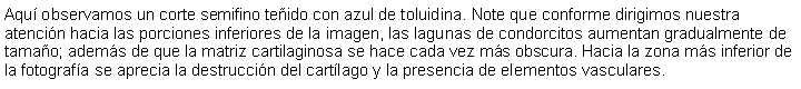 Cuadro de texto: Aqu observamos un corte semifino teido con azul de toluidina. Note que conforme dirigimos nuestra atencin hacia las porciones inferiores de la imagen, las lagunas de condorcitos aumentan gradualmente de tamao; adems de que la matriz cartilaginosa se hace cada vez ms obscura. Hacia la zona ms inferior de la fotografa se aprecia la destruccin del cartlago y la presencia de elementos vasculares. 