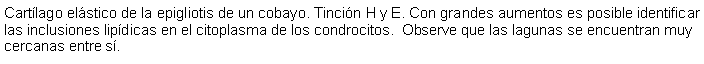 Cuadro de texto: Cartlago elstico de la epigliotis de un cobayo. Tincin H y E. Con grandes aumentos es posible identificar las inclusiones lipdicas en el citoplasma de los condrocitos.  Observe que las lagunas se encuentran muy cercanas entre s. 