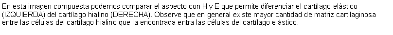 Cuadro de texto: En esta imagen compuesta podemos comparar el aspecto con H y E que permite diferenciar el cartlago elstico (IZQUIERDA) del cartlago hialino (DERECHA). Observe que en general existe mayor cantidad de matriz cartilaginosa entre las clulas del cartlago hialino que la encontrada entra las clulas del cartlago elstico. 